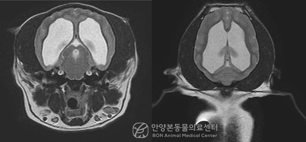 강아지 발작 증상 원인 파악 및 진단을 위한 MRI 검사 결과, 강아지 뇌수두증 환자의 MRI 모습